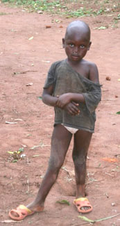 A malnourished and ill-clothed Congolese child